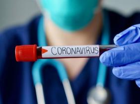 Photo of Coronavirus : 1287 nouveaux cas, 626 guérisons et 21 décès