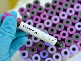Photo of Coronavirus: 239 nouveaux cas, 186 guérisons et 3 décès