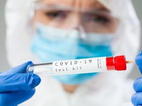 Photo of Coronavirus : 93 nouveaux cas, 82 guérisons et 03 décès