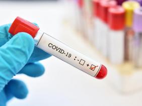 Photo of Coronavirus : 138 nouveaux cas, 107 guérisons et 04 décès