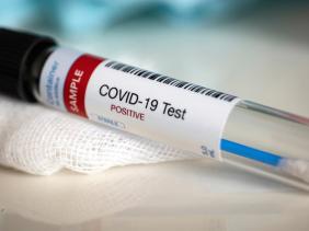 Photo of Coronavirus : 385 nouveaux cas, 262 guérisons et 9 décès ces dernières 24 heures en Algérie